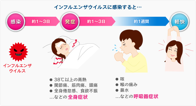 インフルエンザに感染するとこうなる。