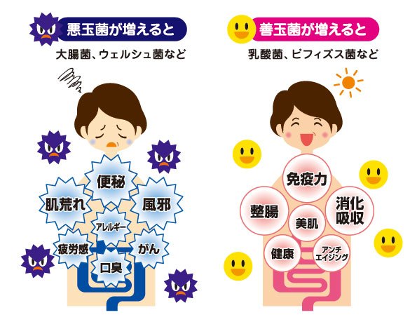 のり面屋にヨーグルト摂取のススメ