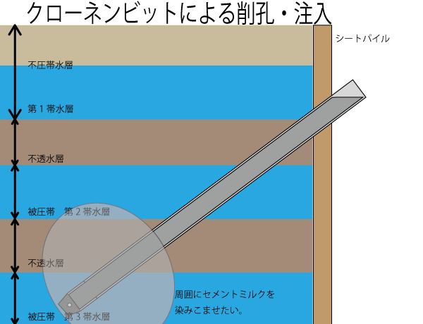 クローネンビットによる注入