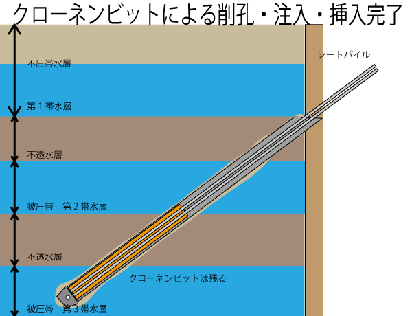 クローネンビットによる削孔注入挿入完了