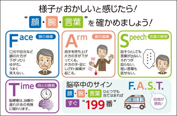 脳卒中
