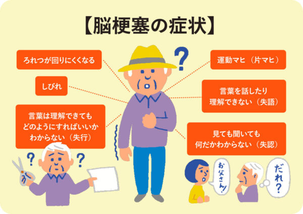 脳梗塞　症状